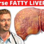 Reverse Fatty Liver with Keto: How Quickly Can You See Results?