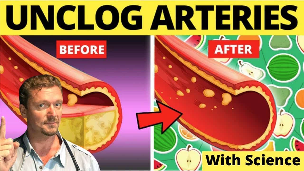 Food That Clean Arteries!