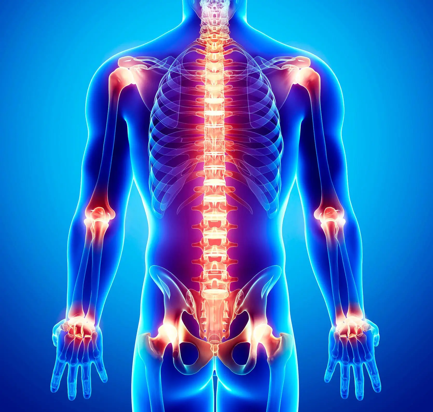 Sensory Neurons: Joint Deformities Treatable