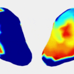 Labor 3D Maps in Real-Time with Imaging Tech