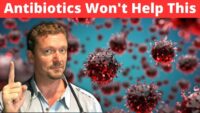 Antibiotic Use: When They Fail