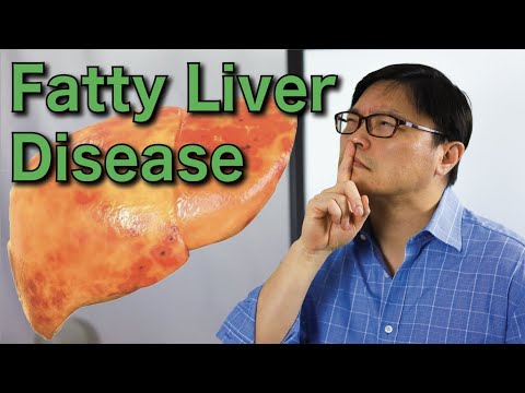 Natural Fatty Liver Disease Reversal | Jason Fung