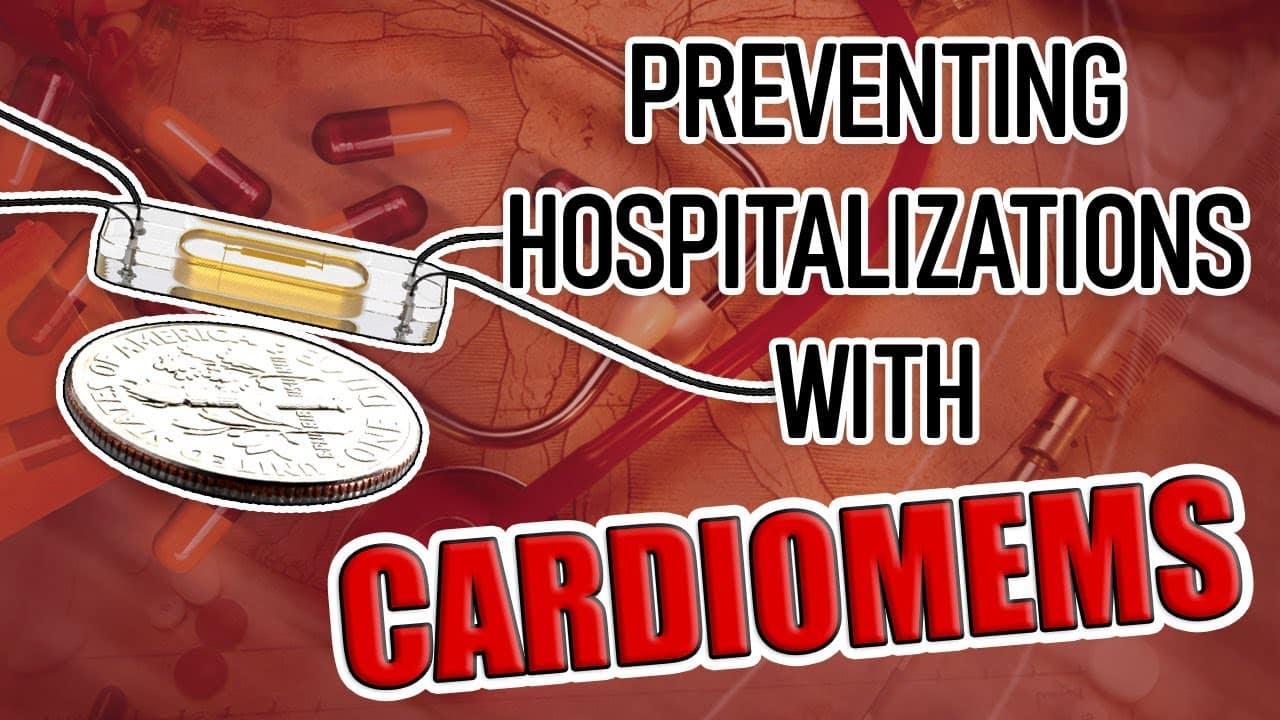 Monitor Heart Failure with CardioMEMS, Avoid Hospitalization