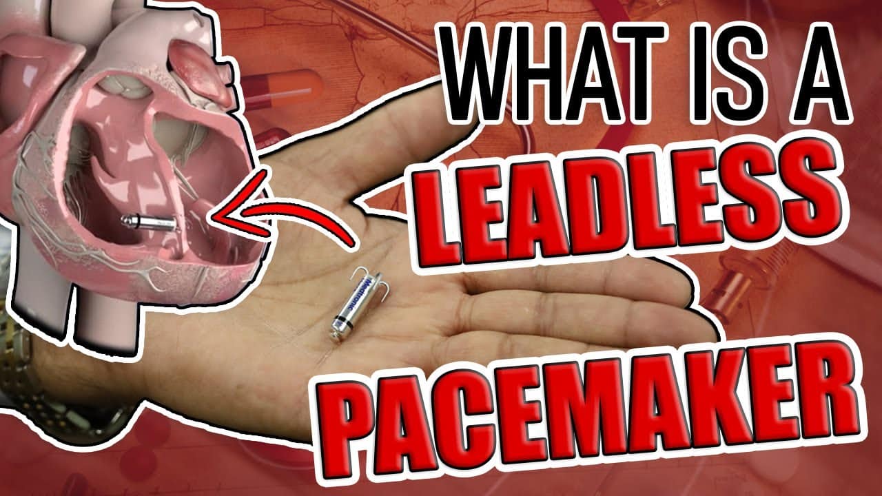 Leadless Pacemakers: What Are They?