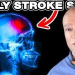 10 Early Signs of Stroke – Beware!