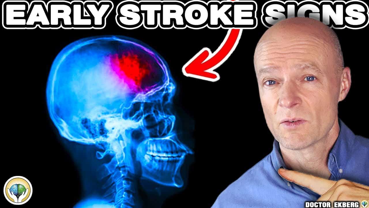 10 Early Signs of Stroke – Beware!