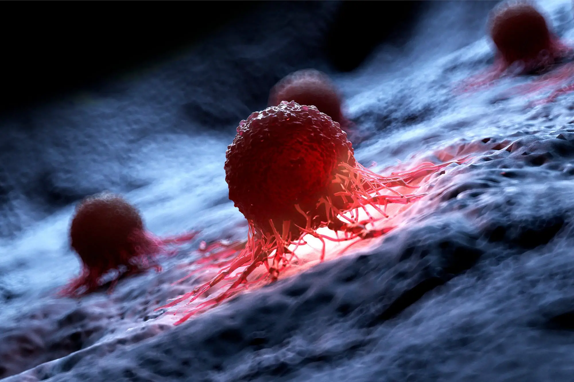 New Therapy Eradicates Gastric Cancer Permanently