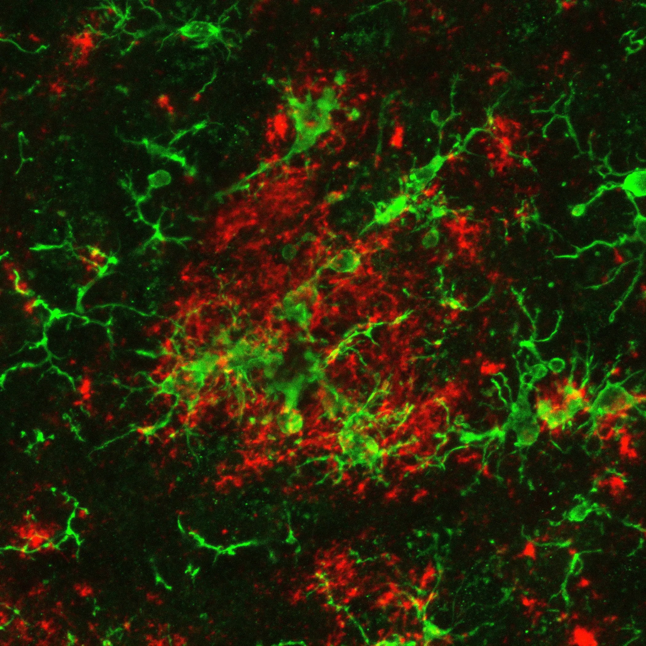 New Method Boosts Brain Immune Cells, Cuts Alzheimer’s Risk