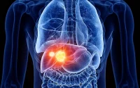 Liver Cancer Study Reveals Hidden Hero