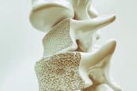 Common Osteoporosis Tool Found Ineffective