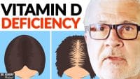 Types of People Who May Have Vitamin D Deficiency | Dr. Steven Gundry