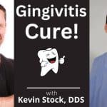 Gingivitis Cure: 7 Steps from a Dentist + Fluoride, Cavities, Brushing & More!