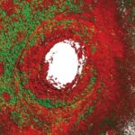 Scientists Identify Immune Cells Creating Skin Defense Shields