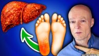10 Ways Your Feet Reveal Insights About Your Liver Health