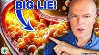 The Top Cholesterol Myth You Should Understand
