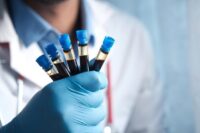 New Blood Test Detects and Tracks Alzheimer’s With 92% Accuracy