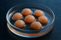 Stanford Scientists Recreate Human Pain Pathway in Lab Dish
