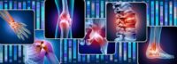 Groundbreaking Study May Slash Osteoarthritis Costs by $486B