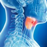 3 Tips from Mayo Clinic Doctor to Lower Head & Neck Cancer Risk