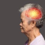China’s Dementia Crisis: Surge in Alzheimer’s Cases