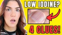 4 Subtle Signs of Iodine Deficiency in Skin, Hair, and Nails