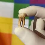 Ancient DNA Shows Pre-Columbian Leprosy in America