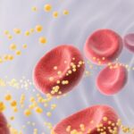 Atherosclerosis Exhibits Tumor-Like Growth, Surprising Scientists
