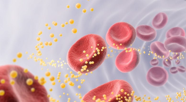 Atherosclerosis Exhibits Tumor-Like Growth, Surprising Scientists