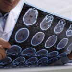 Could Recharging Brain Cells Treat MS?