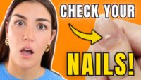 Nail Signs Indicating Nutrient Deficiency: What to Know