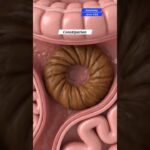 Exploring Constipation: Gut Health & Anatomy Art USA