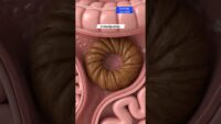 Exploring Constipation: Gut Health & Anatomy Art USA