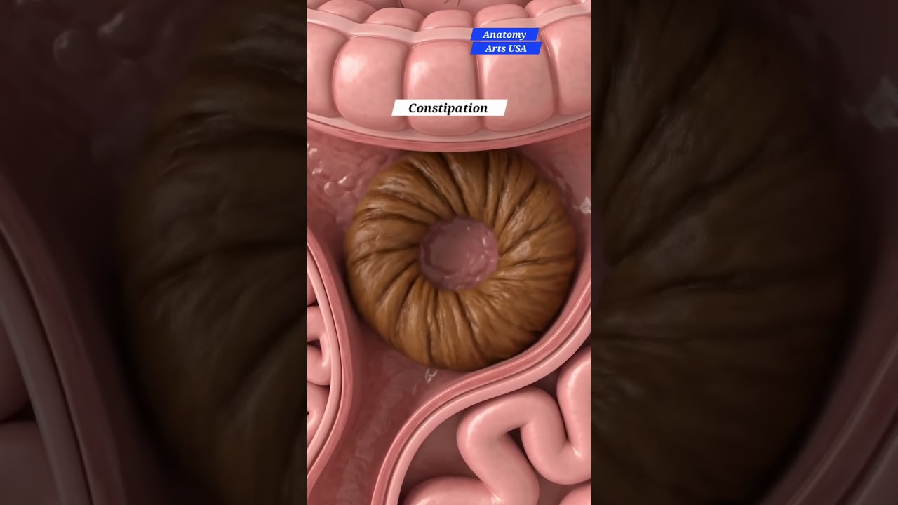 Exploring Constipation: Gut Health & Anatomy Art USA