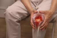 Why Many Knee X-Rays May Be More Harmful Than Helpful