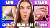 Hidden Signs of Insulin Resistance: Differences in Women vs. Men