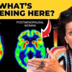 The Menopause Brain Shift: Essential Insights for Women