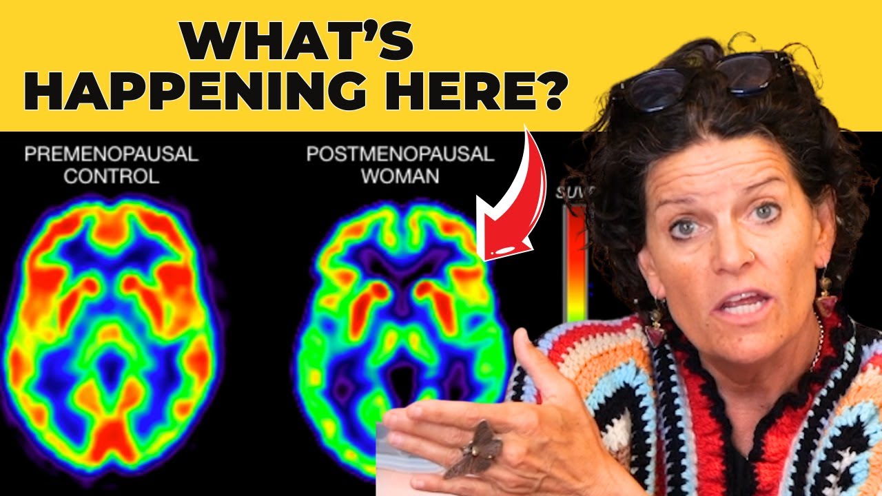 The Menopause Brain Shift: Essential Insights for Women