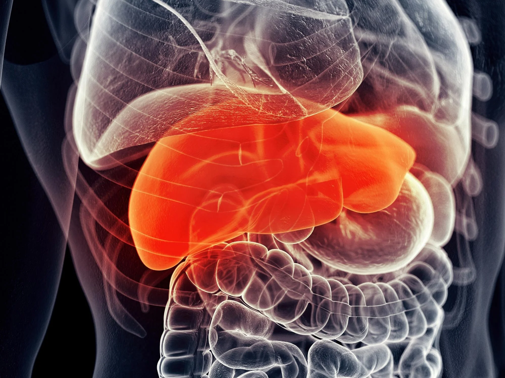 Drugs Unite to Combat World’s Most Common Liver Disease
