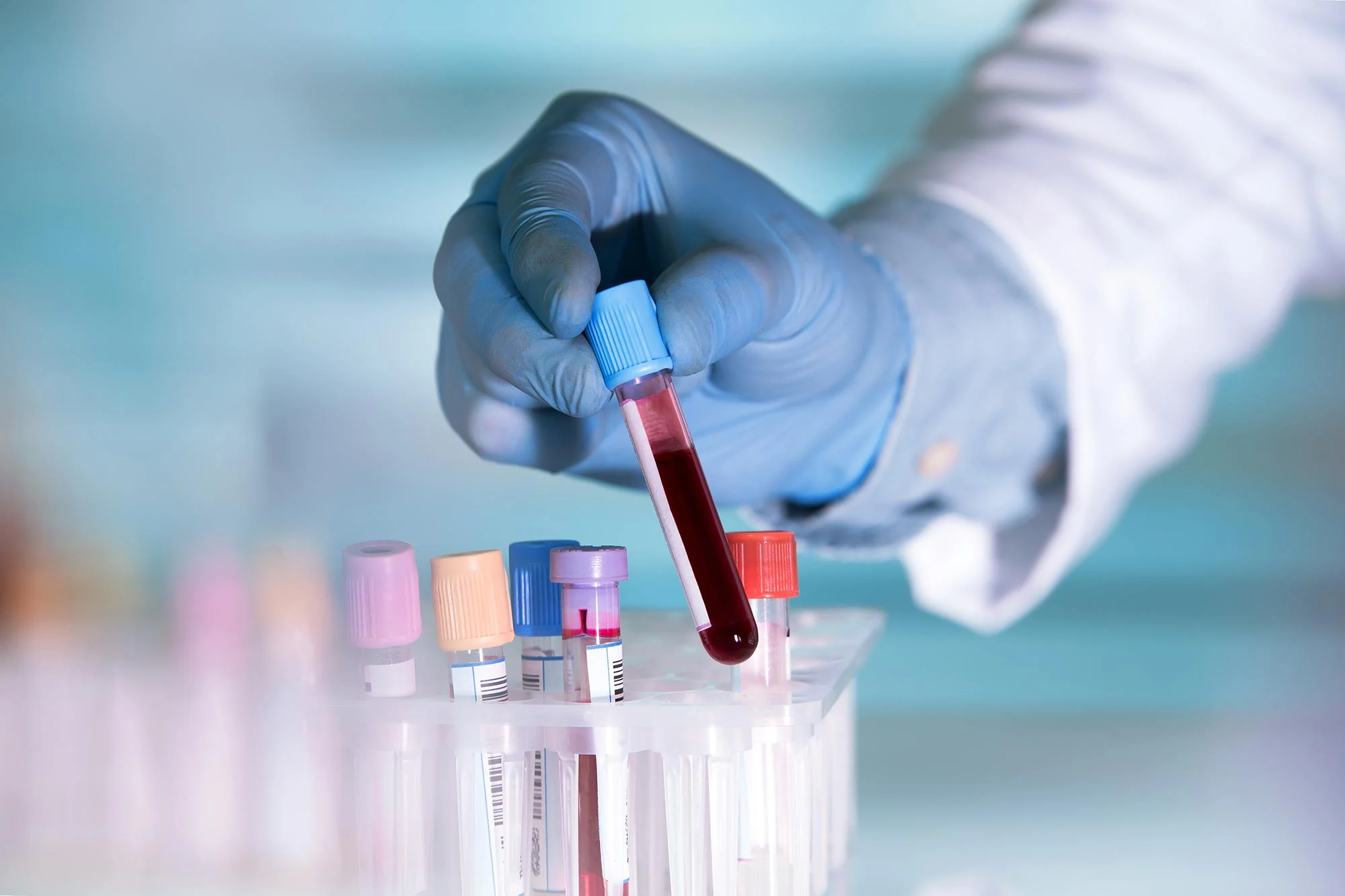 New Blood Test Detects Head and Neck Cancer Early, 10 Years Ahead