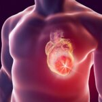 Ultra-Processed Foods: Their Harm May Rival Smoking
