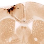 Stroke Damage Reversed: Stem Cells Regenerate Brain Tissue