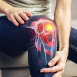 Safer Knee Osteoarthritis Treatment Offers Non-Surgical Relief