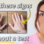 8 Indicators of Improved Insulin Resistance Without Blood Tests