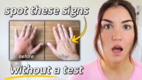 8 Indicators of Improved Insulin Resistance Without Blood Tests