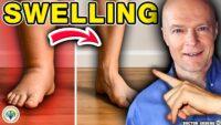 Top Method to Reduce Swelling in Legs and Ankles