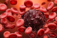 AI Blood Cell Analyzer Surpasses Experts in Leukemia Detection