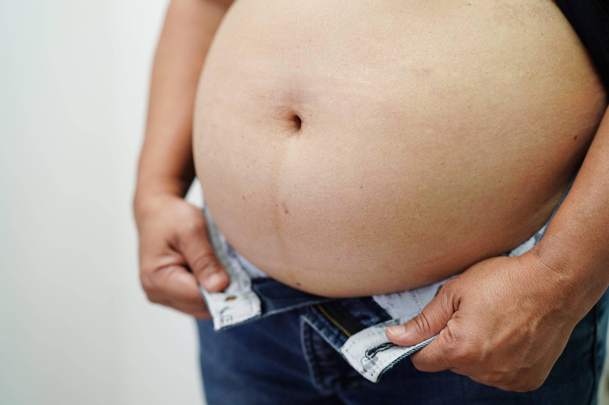 Experts Warn: Obesity Treatment May Evolve Into Two-Tier System