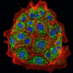 Blocking One Fat Molecule May Protect Your Kidneys