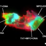 Scientists Discover Hidden Blood Pattern in Long COVID