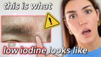Recognizing Iodine Deficiency: Key Signs to Look For